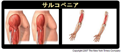 テストステロン補充療法