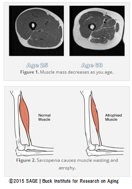 テストステロン補充療法